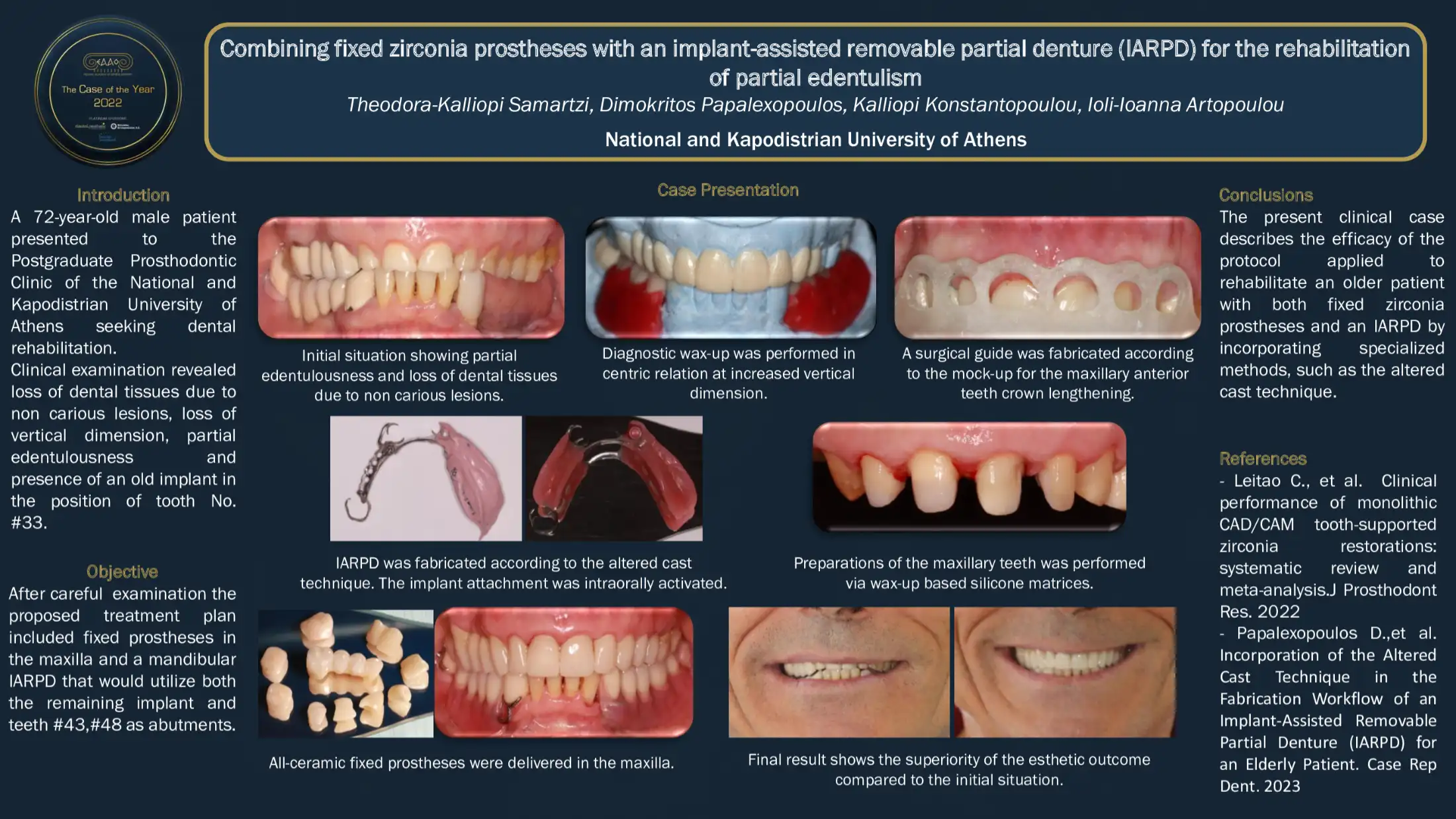 Combining fixed zirconia prostheses with an implant-assisted removable partial denture (IARPD) for the rehabilitation of partial edentulism.