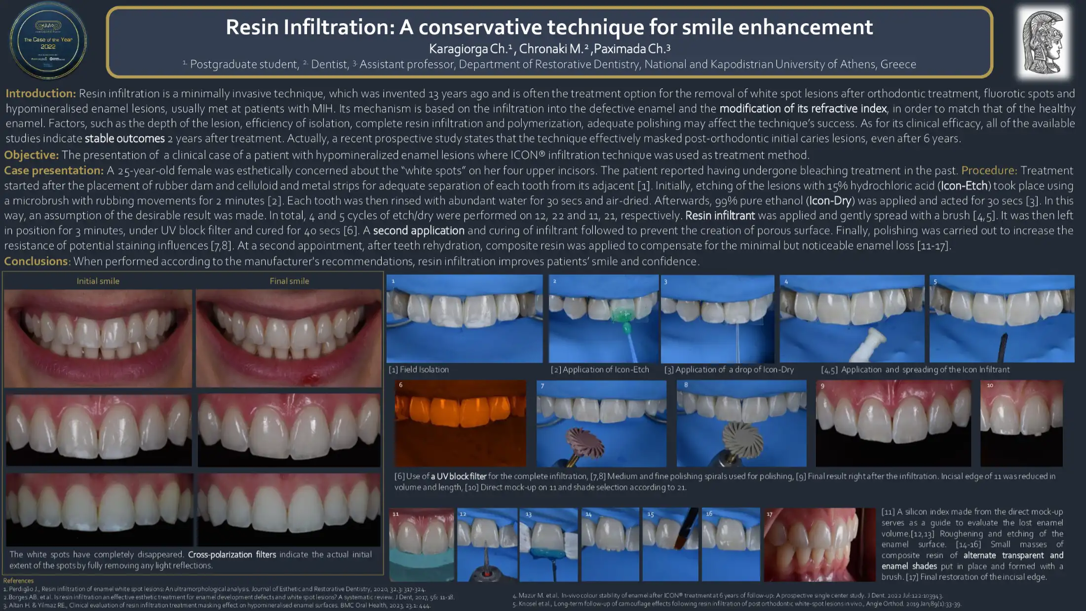 Resin Infiltration: A conservative technique for smile enhancement.