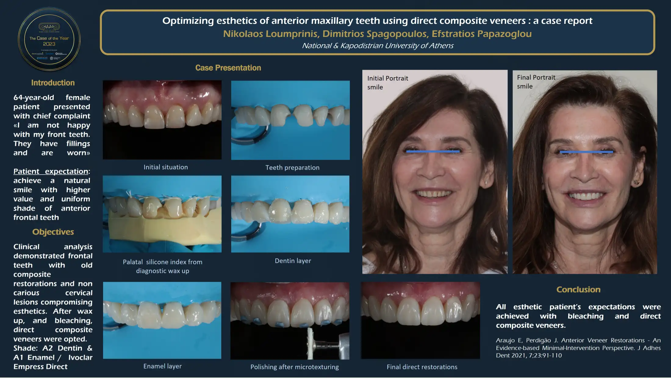 Optimizing esthetics of anterior maxillary teeth using direct composite veneers: a case report.